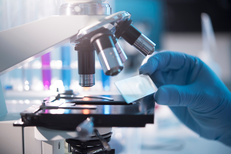 A close-up of a scientist's gloved hand holding a glass slide, preparing to place it under a high-powered microscope in a laboratory setting.